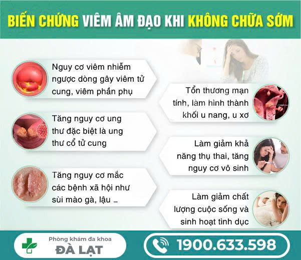 Hình ảnh minh họa